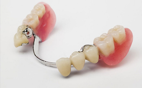 cuidadosamente Hacer Privilegiado Laboratorio AF Dental Labor / Prótesis Removibles